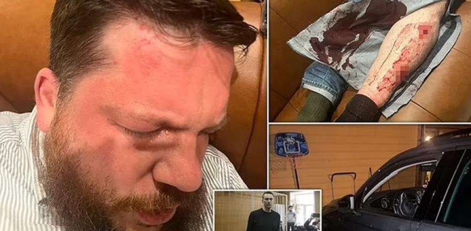 Ayudante de Navalni, atacado a martillazos en Lituania: “Putin quería hacerme bistec”